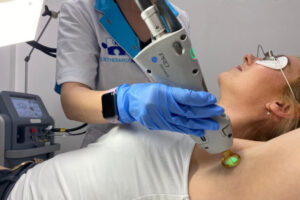 mooi auteursrechten fossiel Laser hair removal at Skin Care Rotterdam - Laserontharing NL